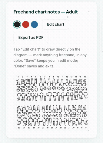 Freehand dental charting: drawing findings directly onto the tooth diagram